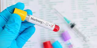 Giám sát chặt các trường hợp nghi ngờ mắc bệnh Marburg 
